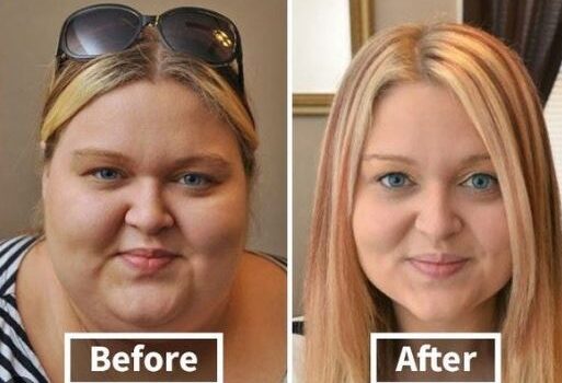18 Amazing Before And After Weight Loss Face Pictures