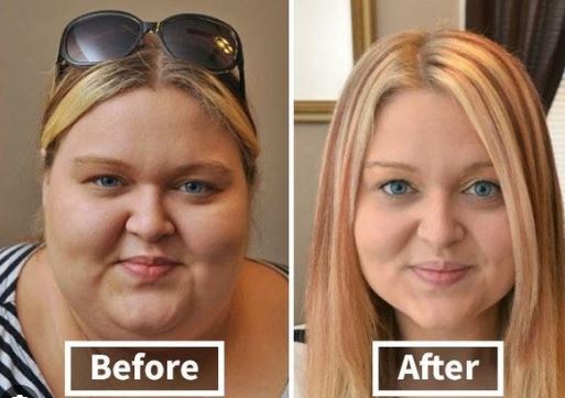 before and after weight loss face pictures? 