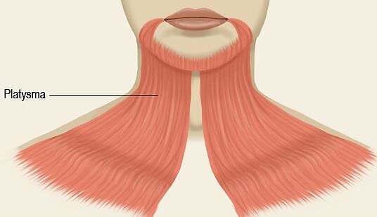 How to get rid of a double chin for good, platysma muscle - double chin reduction