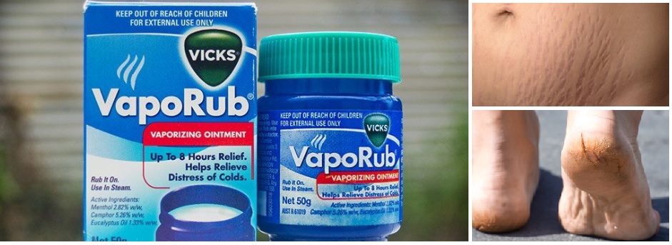 14 Unique Vicks VapoRub Uses - You Have To Try!