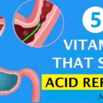 5-Vitamins-To -Stop-Acid-Reflux-Naturally