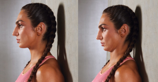 exercises for neck hump